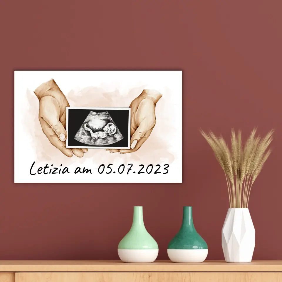 Your photo ultrasound image on canvas - Custom canvas