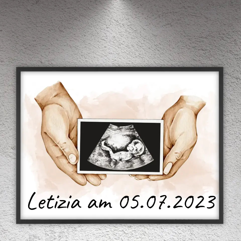 Your photo ultrasound image on canvas - Custom canvas