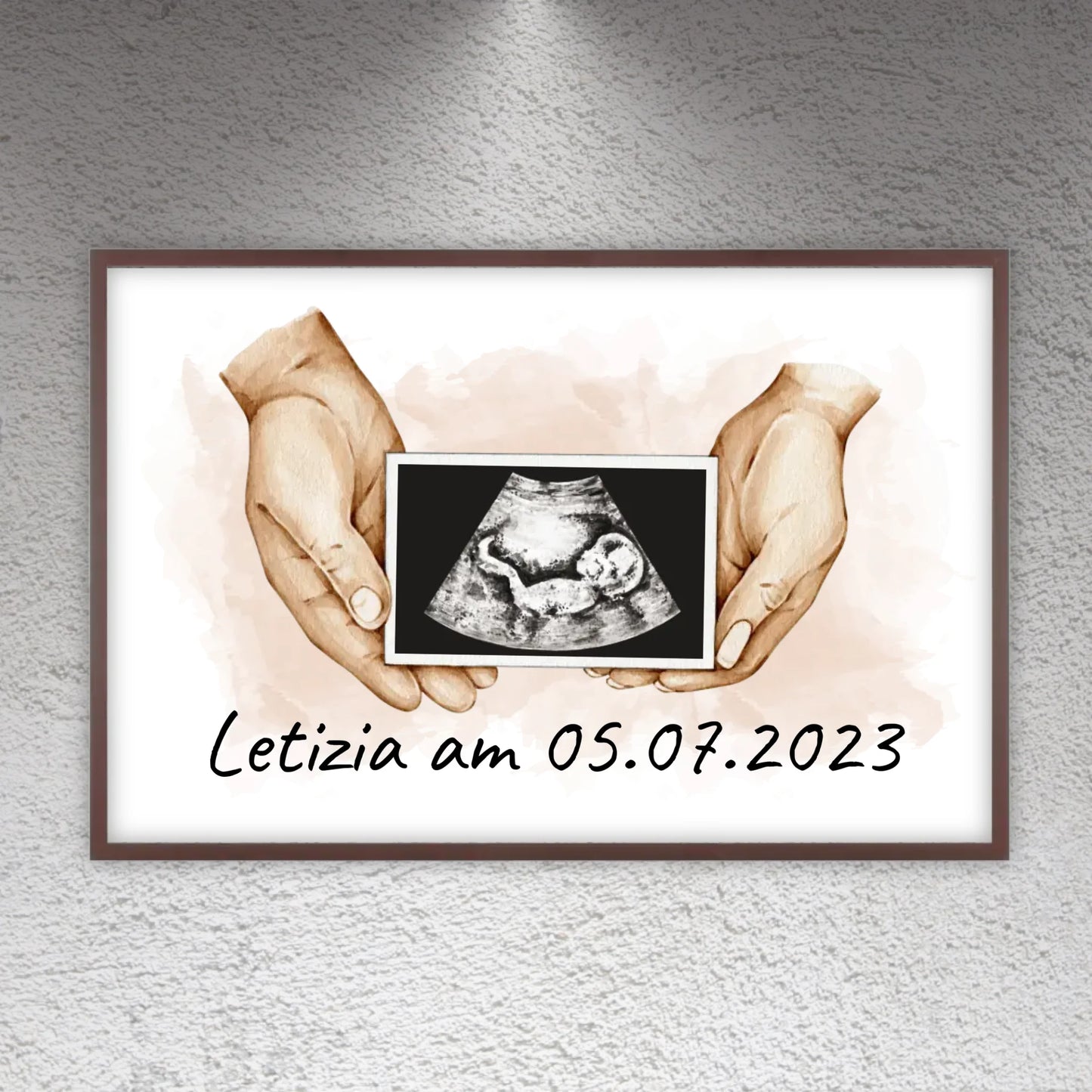 dein Foto Ultraschallbild auf Leinwand - Individuelle Leinwand | Personalize Palace