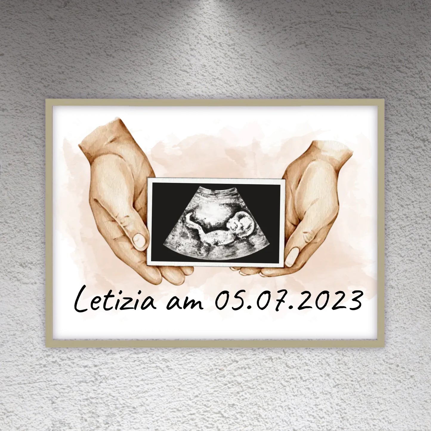 Your photo ultrasound image on canvas - Custom canvas
