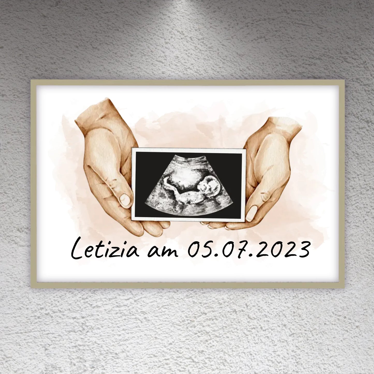 Your photo ultrasound image on canvas - Custom canvas