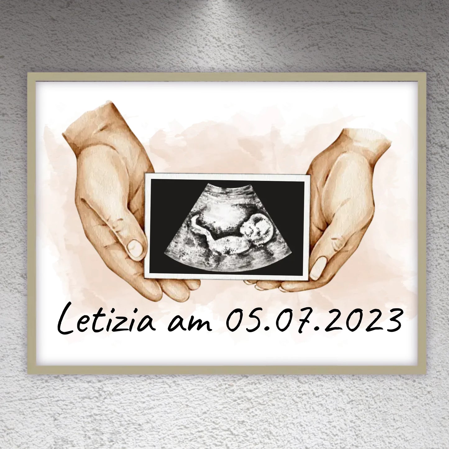 Your photo ultrasound image on canvas - Custom canvas