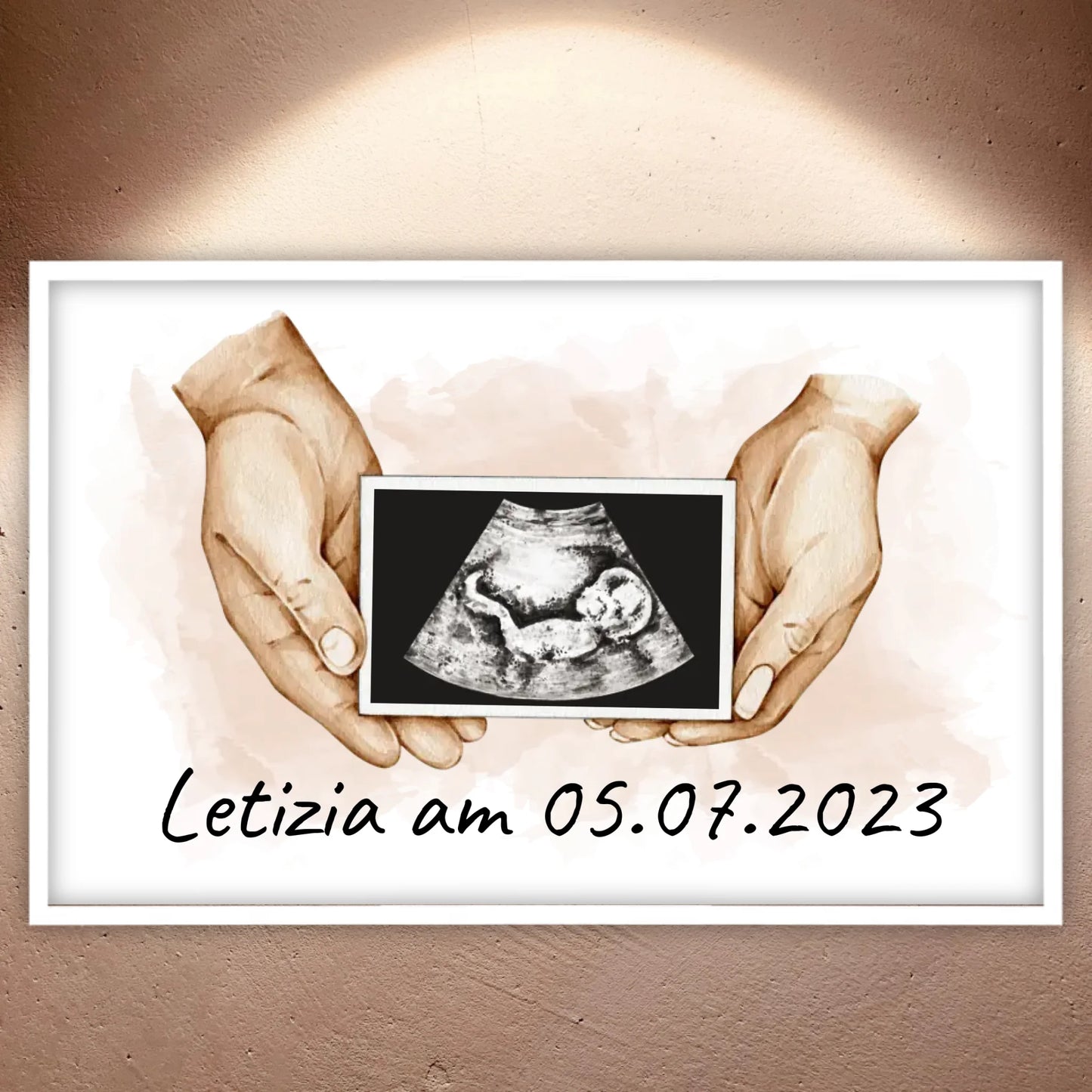 Your photo ultrasound image on canvas - Custom canvas