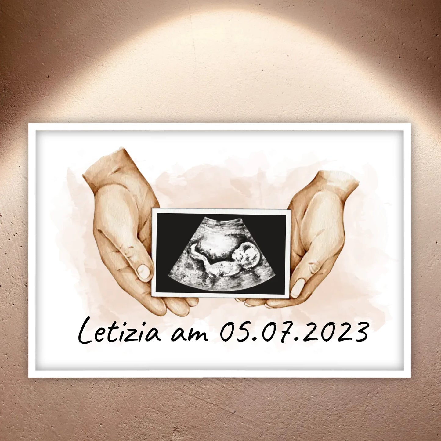 Your photo ultrasound image on canvas - Custom canvas