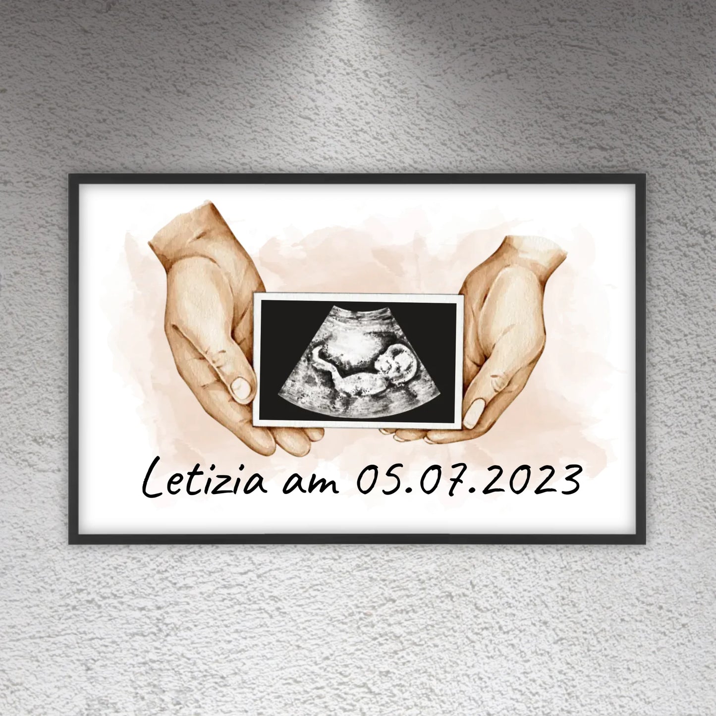 Your photo ultrasound image - Individual picture with gallery frame