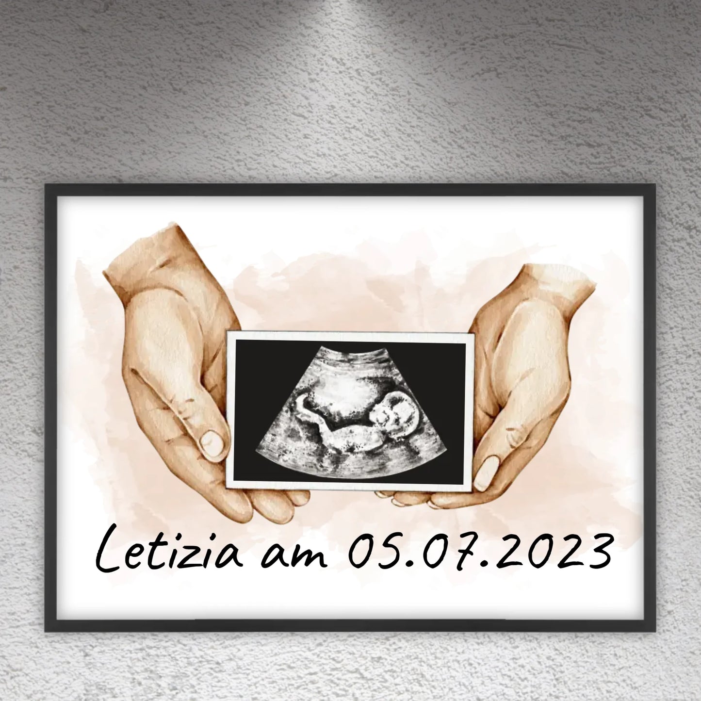 Your photo ultrasound image - Individual picture with gallery frame