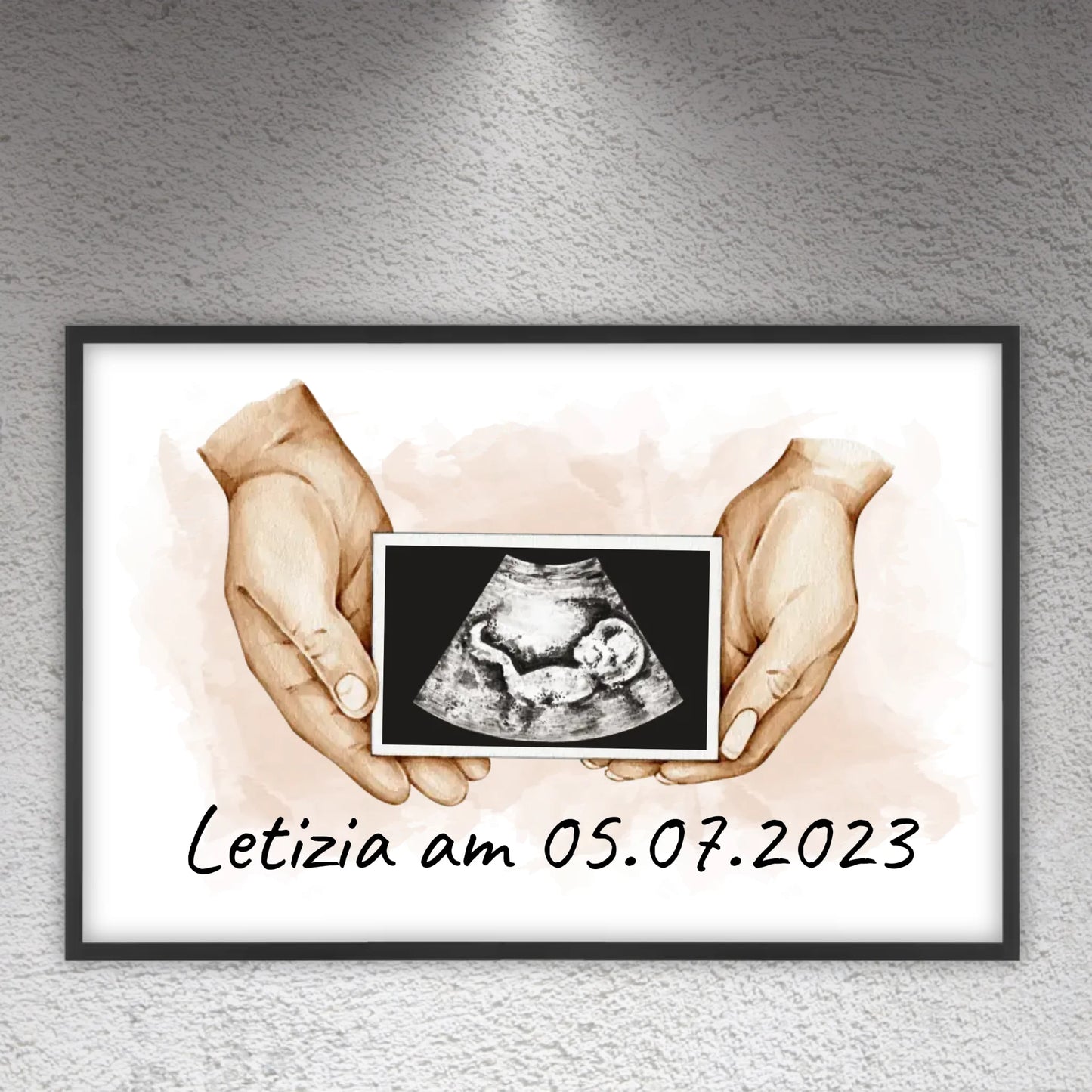 Your photo ultrasound image on canvas - Custom canvas