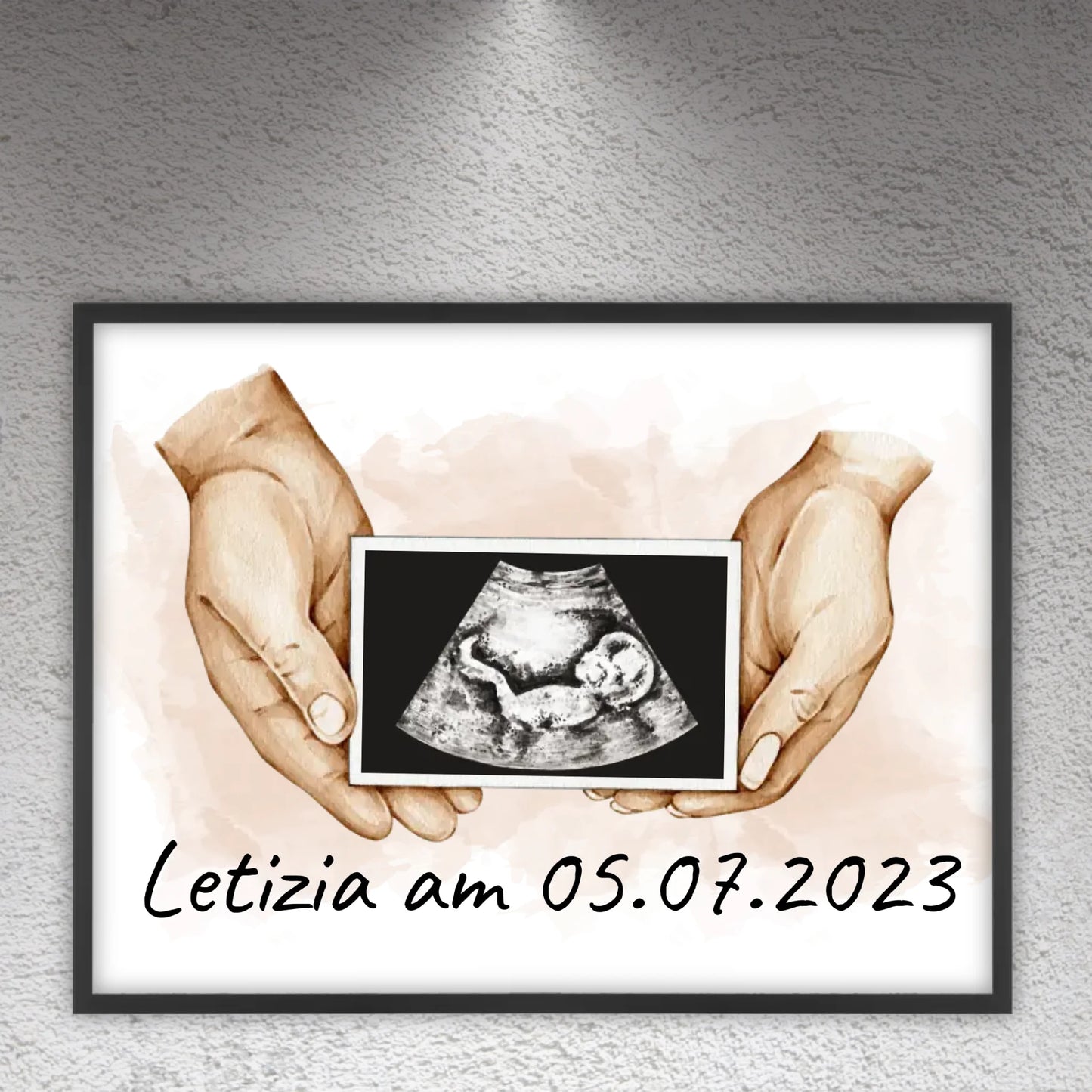 Your photo ultrasound image on canvas - Custom canvas